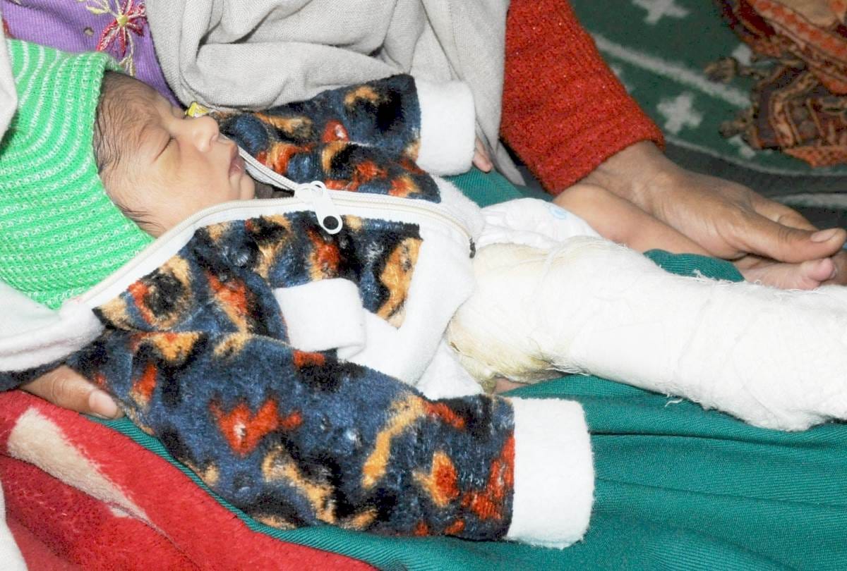 carelessness of doctors during cesarean delivery in lohia hospital