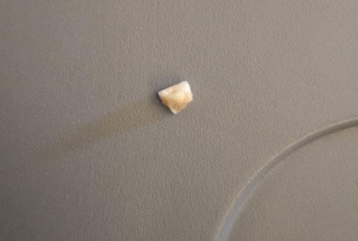 Flight Passenger Finds Human Tooth In Rice Meal Ordered On A Singapore Airline Flight 