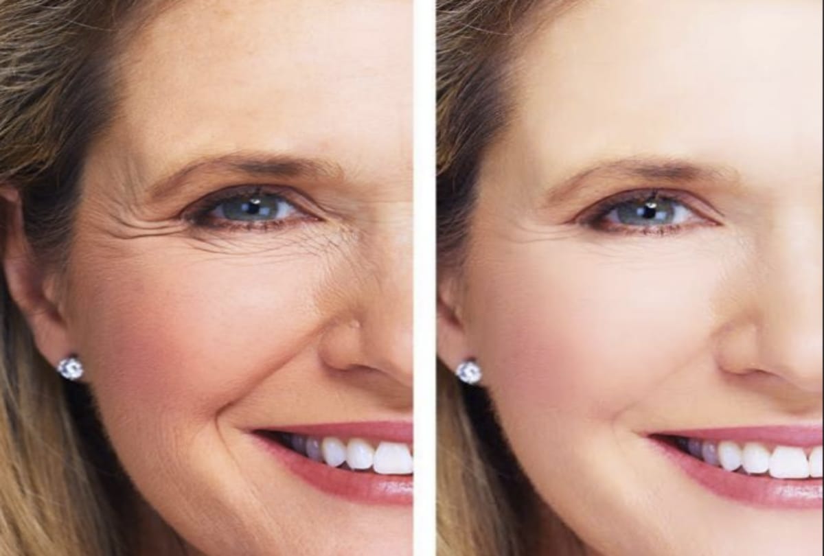 Beauty Tips use this 4 thing with ghee for remove wrinkles