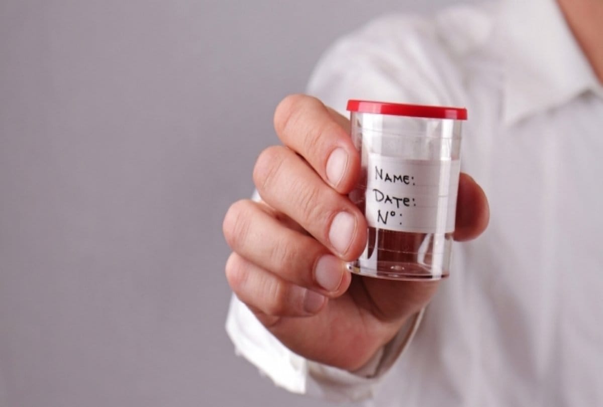 Research revealed that sperm of men weakened by coronavirus