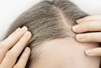 White Hair Problem Know Reason Behind premature Grey Hair and its Symptoms prevention