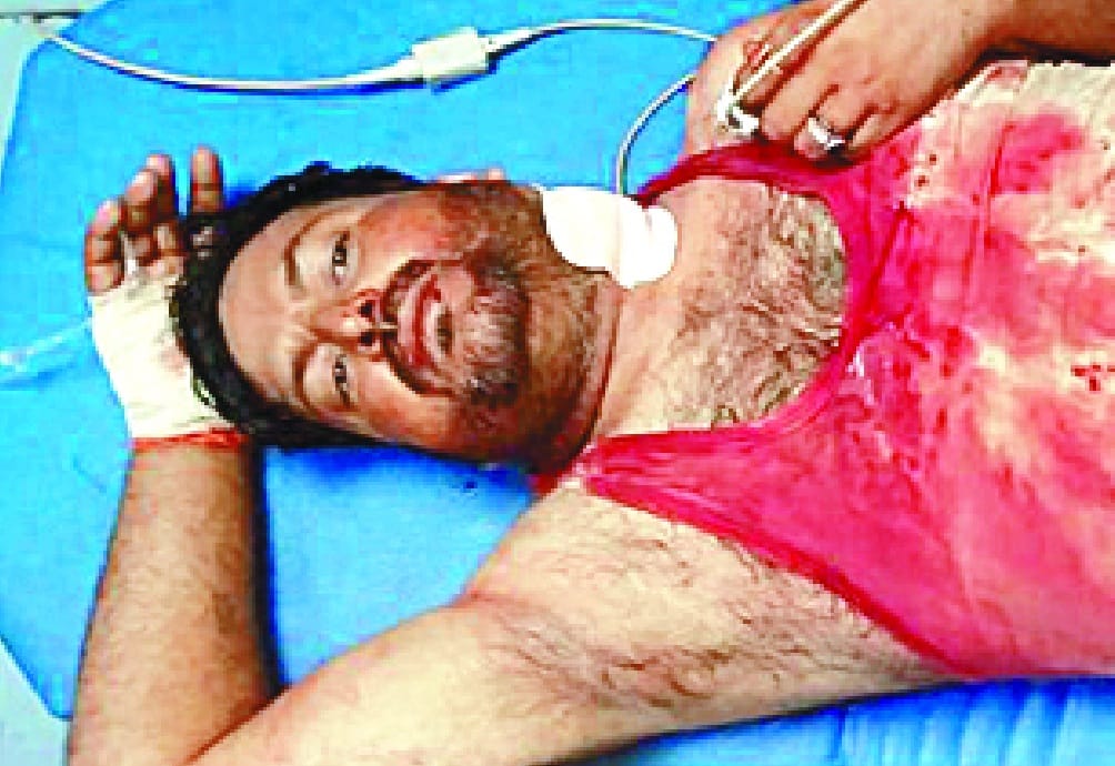 Ration Dealer was shot, Accused arrested
