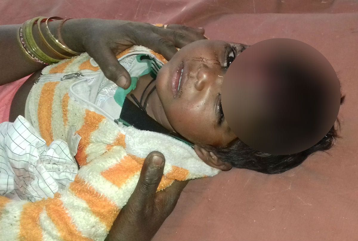 stary dog attack three year old girl in etah