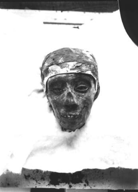 Tutankhamun the king of Egypt death has mysterious history