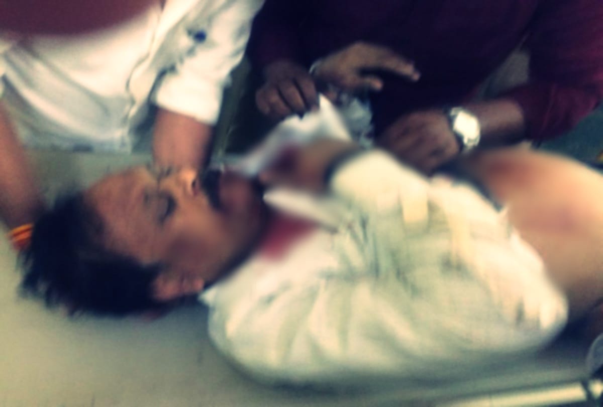 Doctor shot by gun in Rae Bareli refere lucknow in critical condition