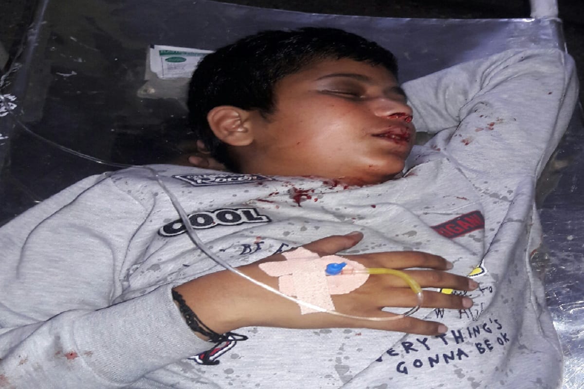 Uncle nephew killed and many injured in car accident at Muaffarnagar