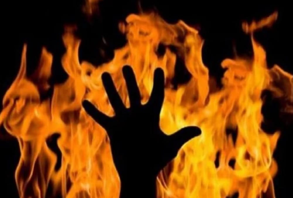 Supervisor Fire on himself after sprinkle petrol in rudrapur near sidcul company