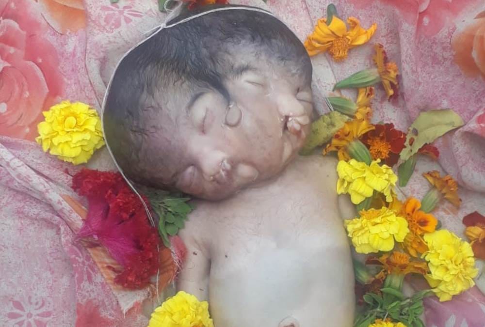 two headed child born in nursing home died within hours