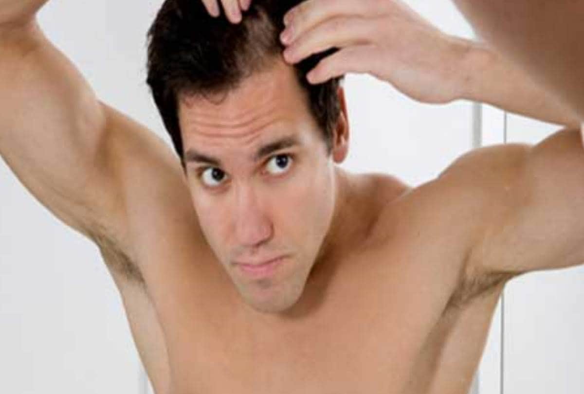 know the  symptoms and prevention of alopecia areata