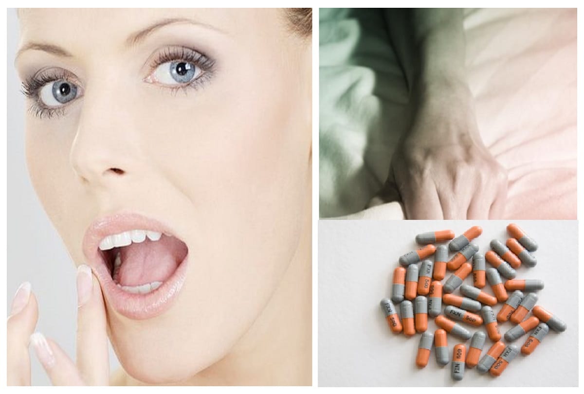 woman has severe allergic reaction after performing oral act with boyfriend had taken penicillin