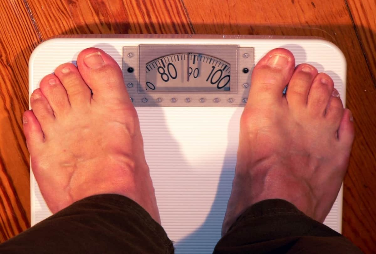 obesity, tips to loose weight, use Endoscopic sleeve gastroplasty technique