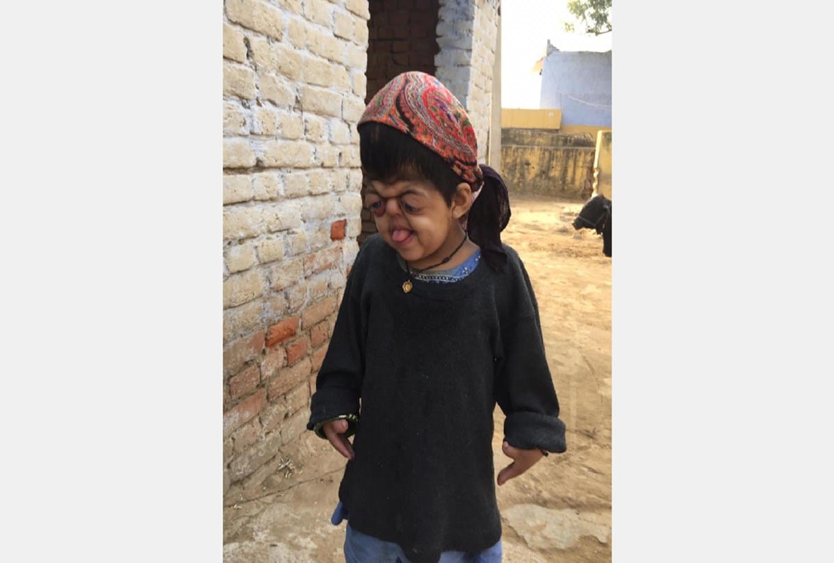 Child has not been able to sleep for five years Due to