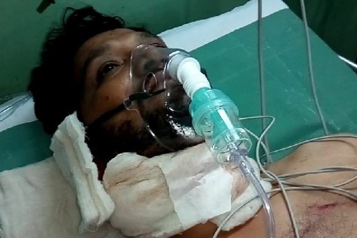 UP: firing in marriage pavilion in Meerut one injured