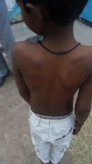 chiksika ne chthr ko pita