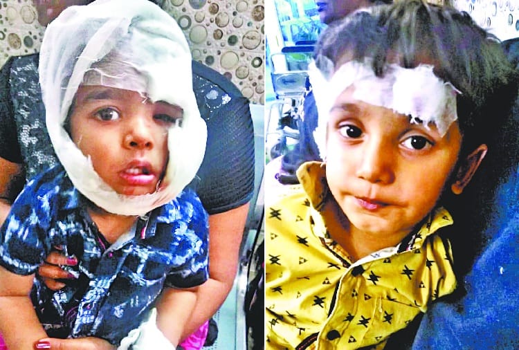 Terror of Stray Dog in Zirakpur, Five Childrens Injured Badly