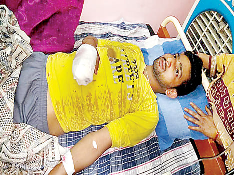 The infamous bandit Babuli gang wreaked havoc on villagers, injuring one of the bullets