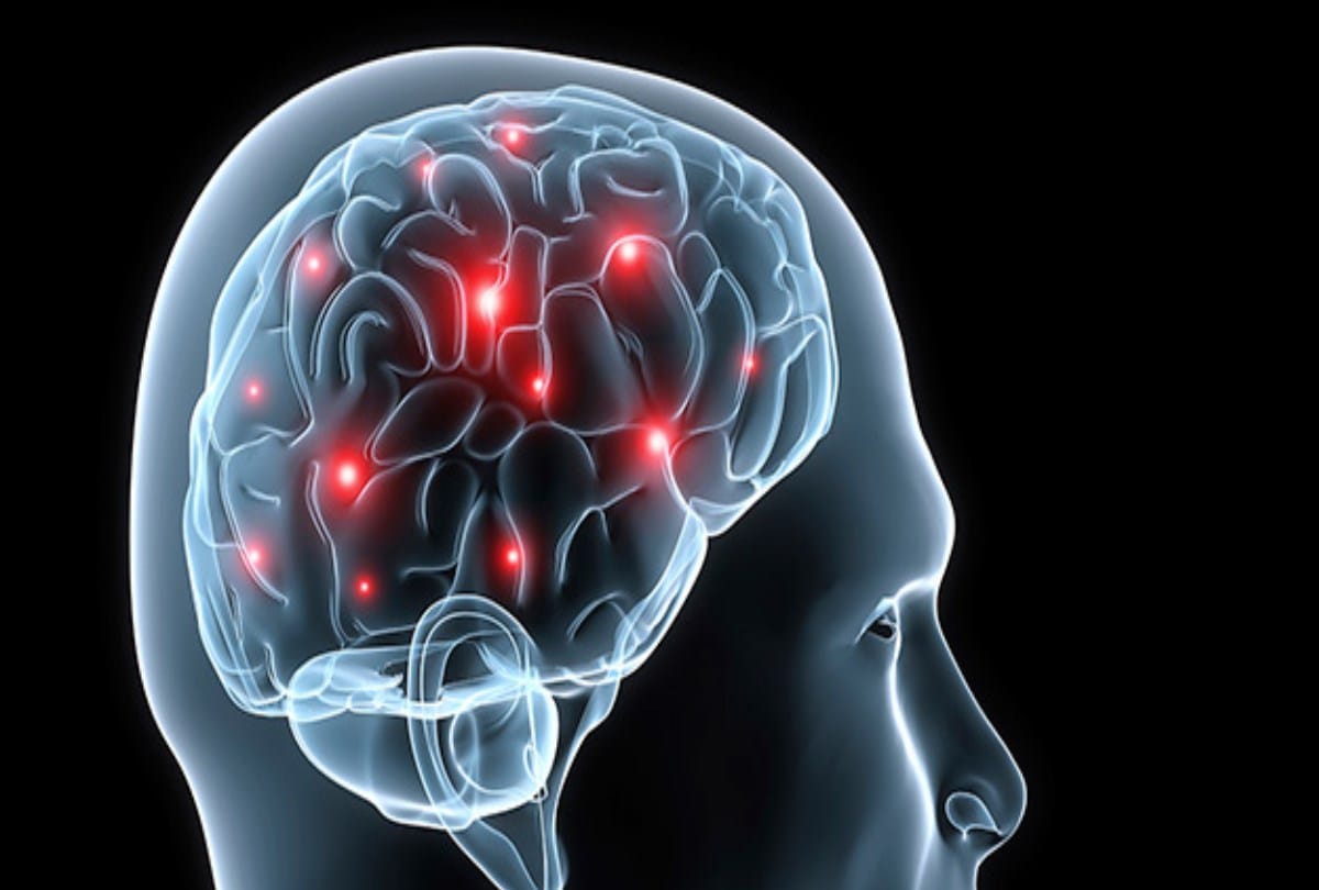 Medicines cure seventy five percent of epilepsy patients completely