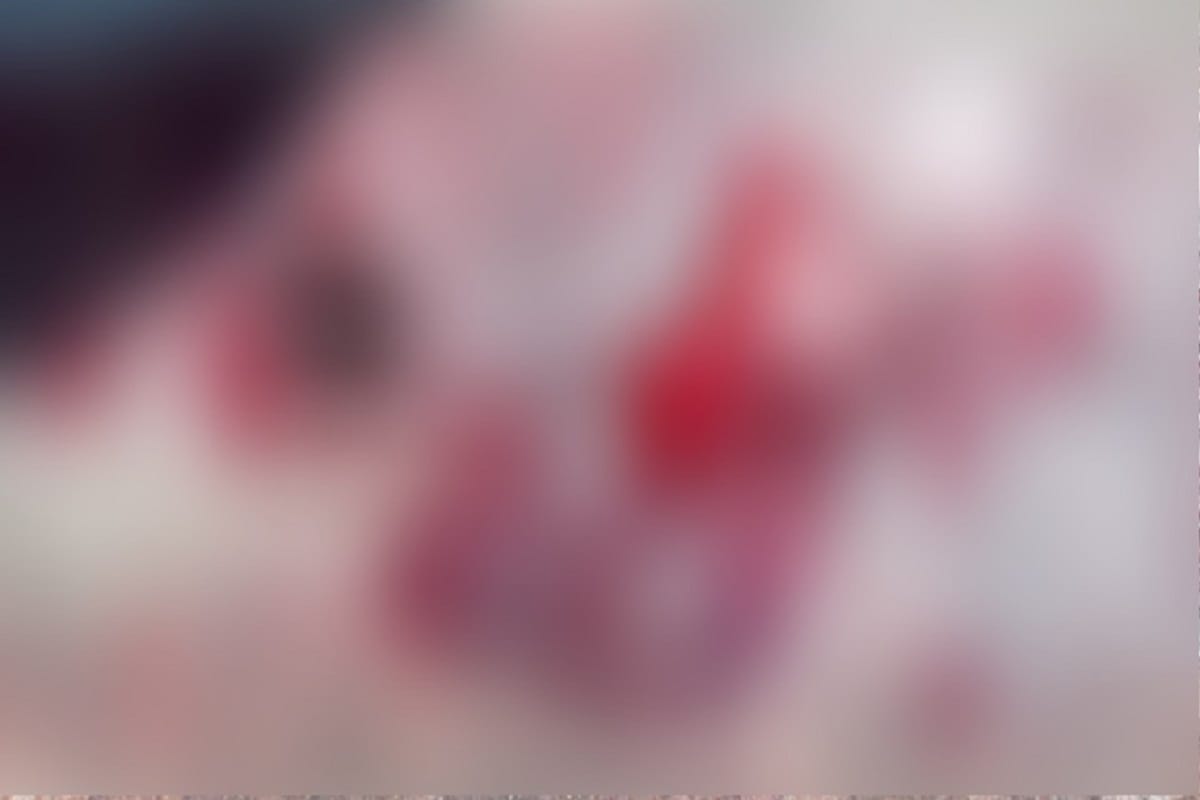 Mother cut her baby's hand with blade in Bijnor