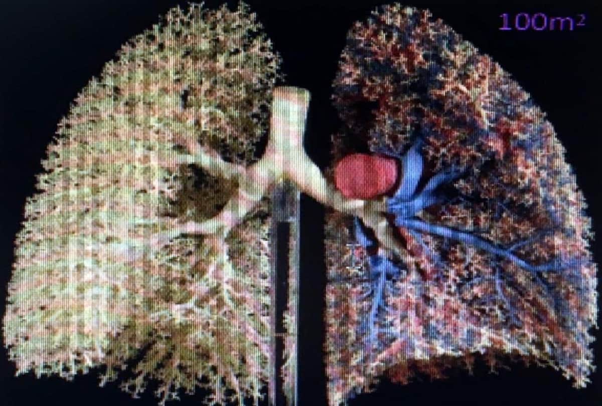 doctor says delhi ncr air pollution is harmful for you