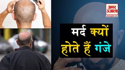 reason behind men baldness