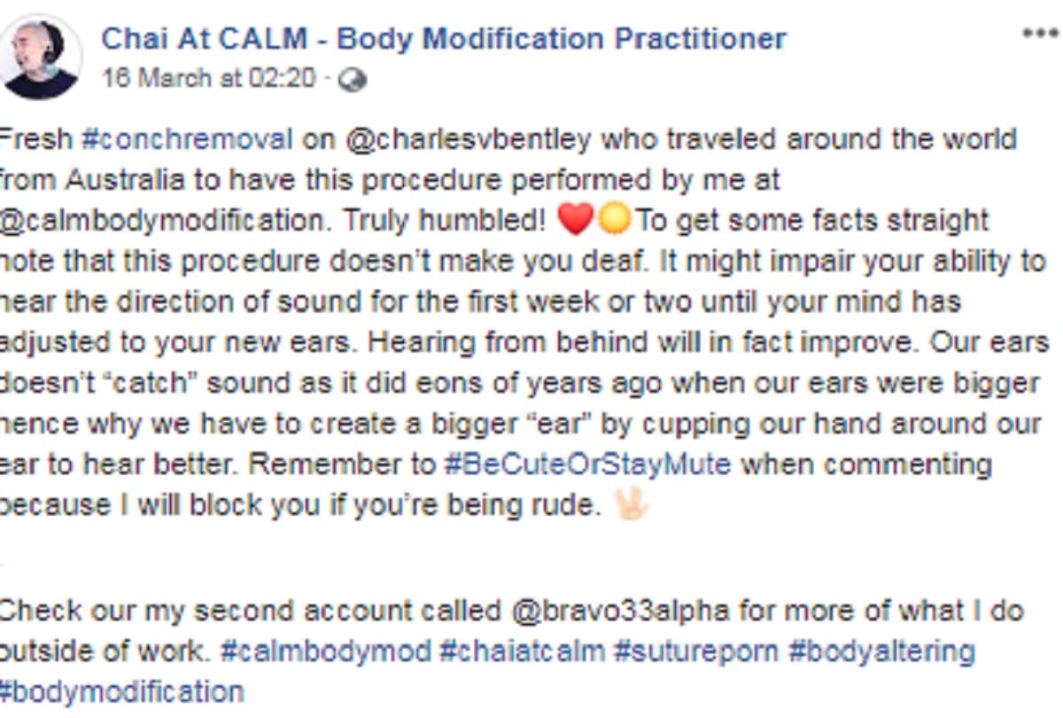 body modification enthusiast has part of ear removed in controversial procedure