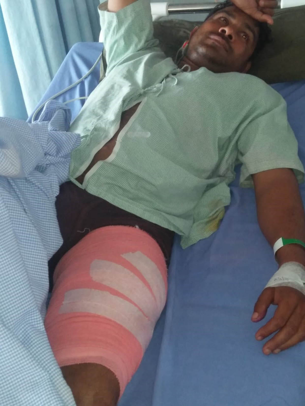 बदमाशों ने सिपाही से नकदी लूटी,मोबाइल लूटने का विरोध पर मारी गोली,हुआ घायल