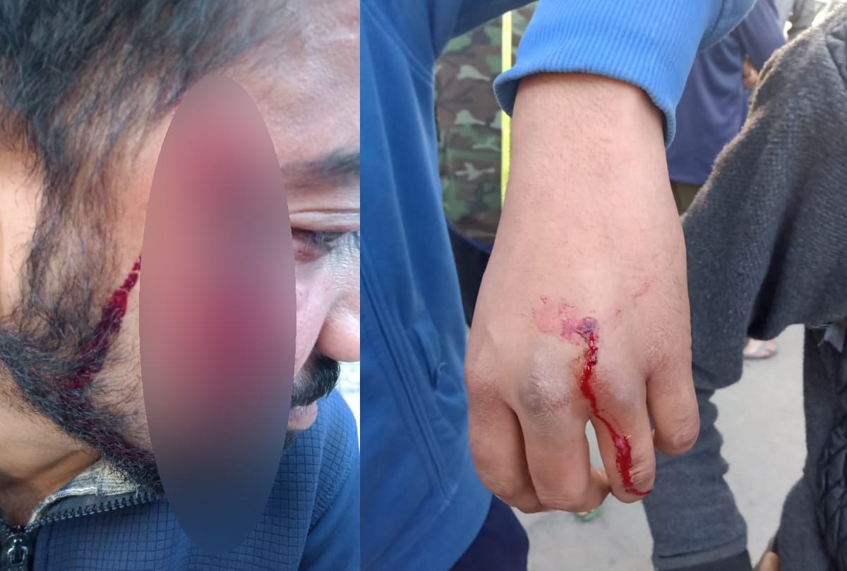 Fight in HPU Shimla Between SFI workers and ABVP workers