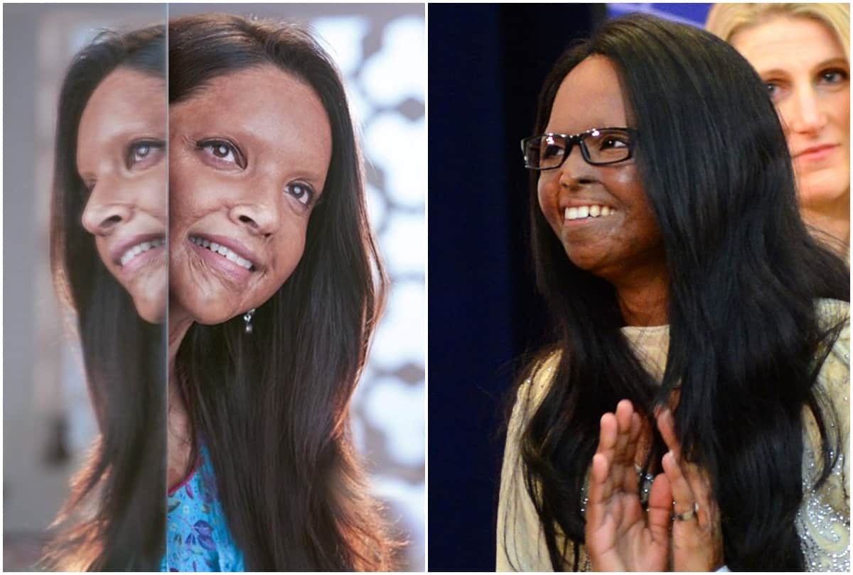 Acid attack survivor laxmi agarwal told her story before chhapaak movie release 