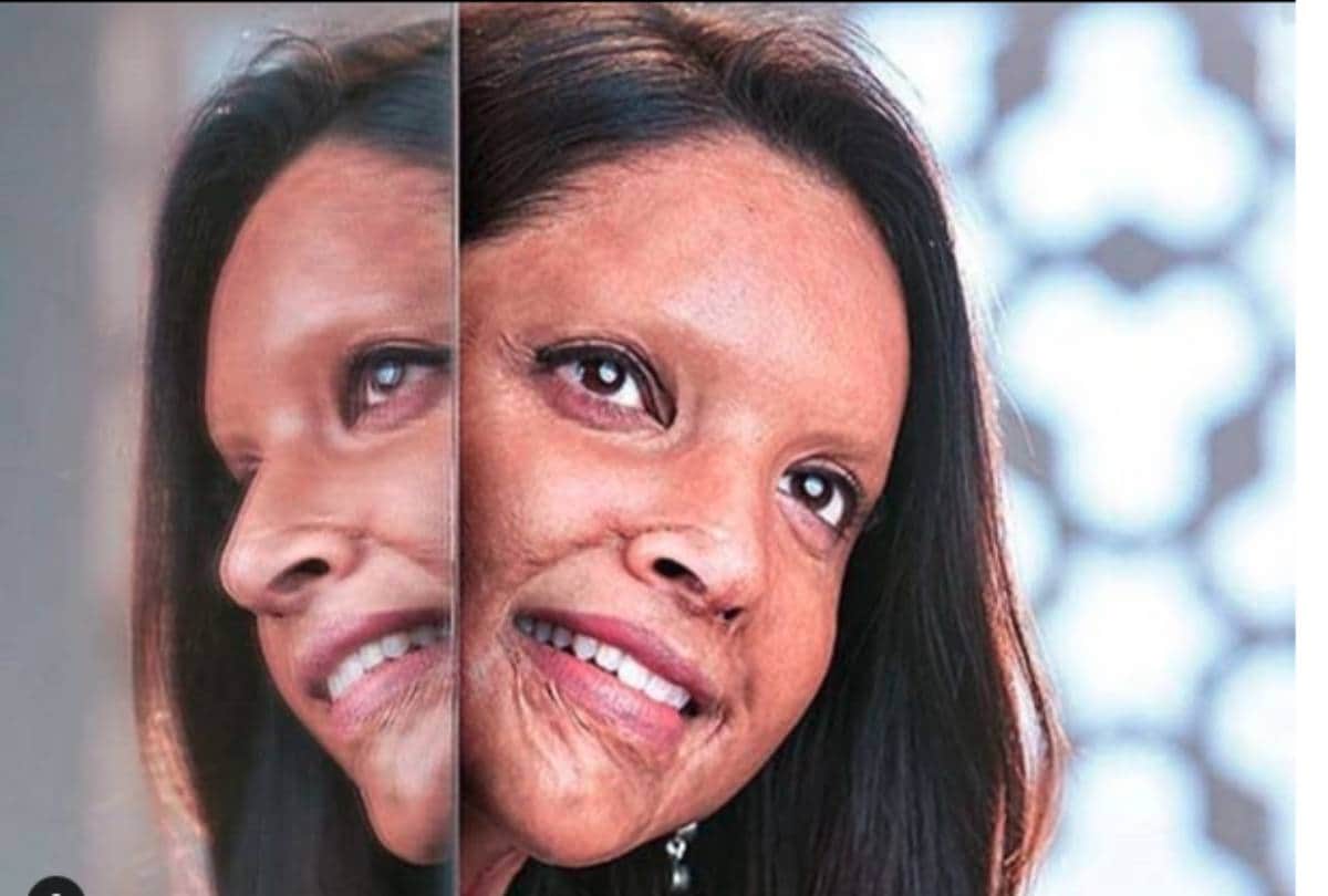 deepika padukone playing role of acid attack survivor in film chhapaak know who is laxmi agarwal