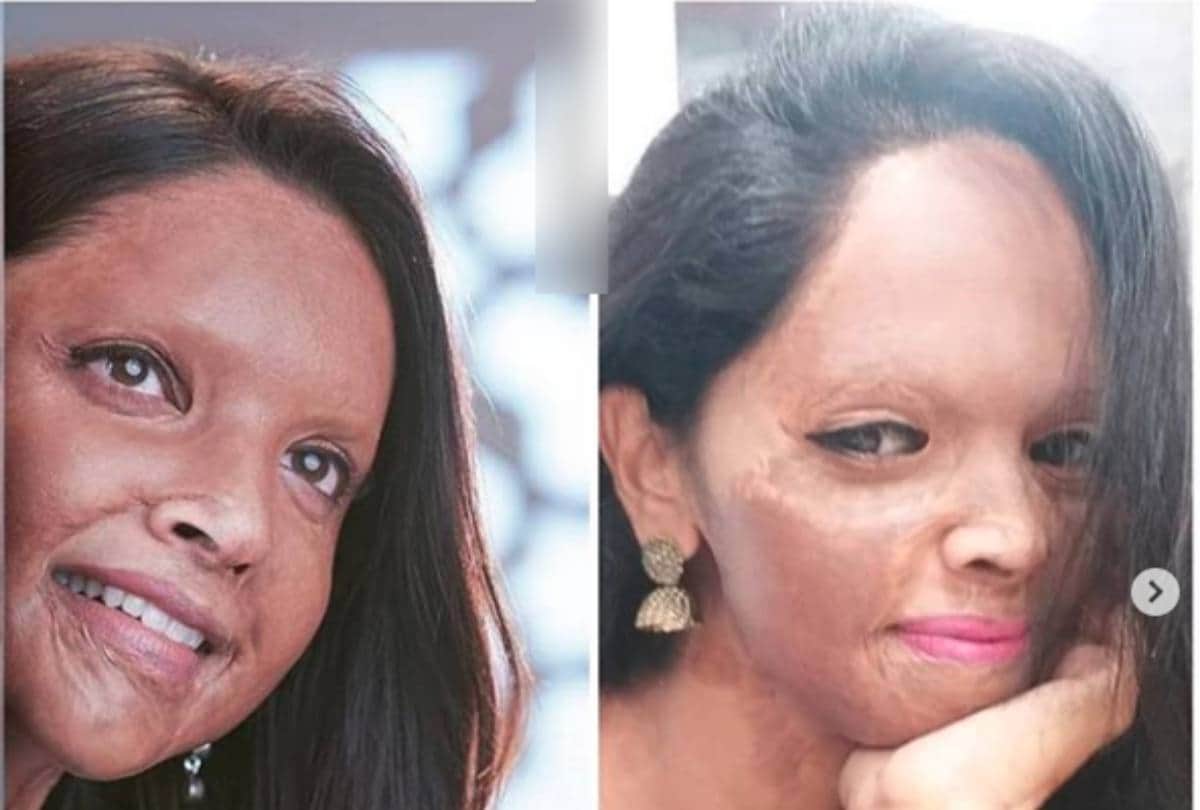 deepika padukone first look of film chhapaak viral