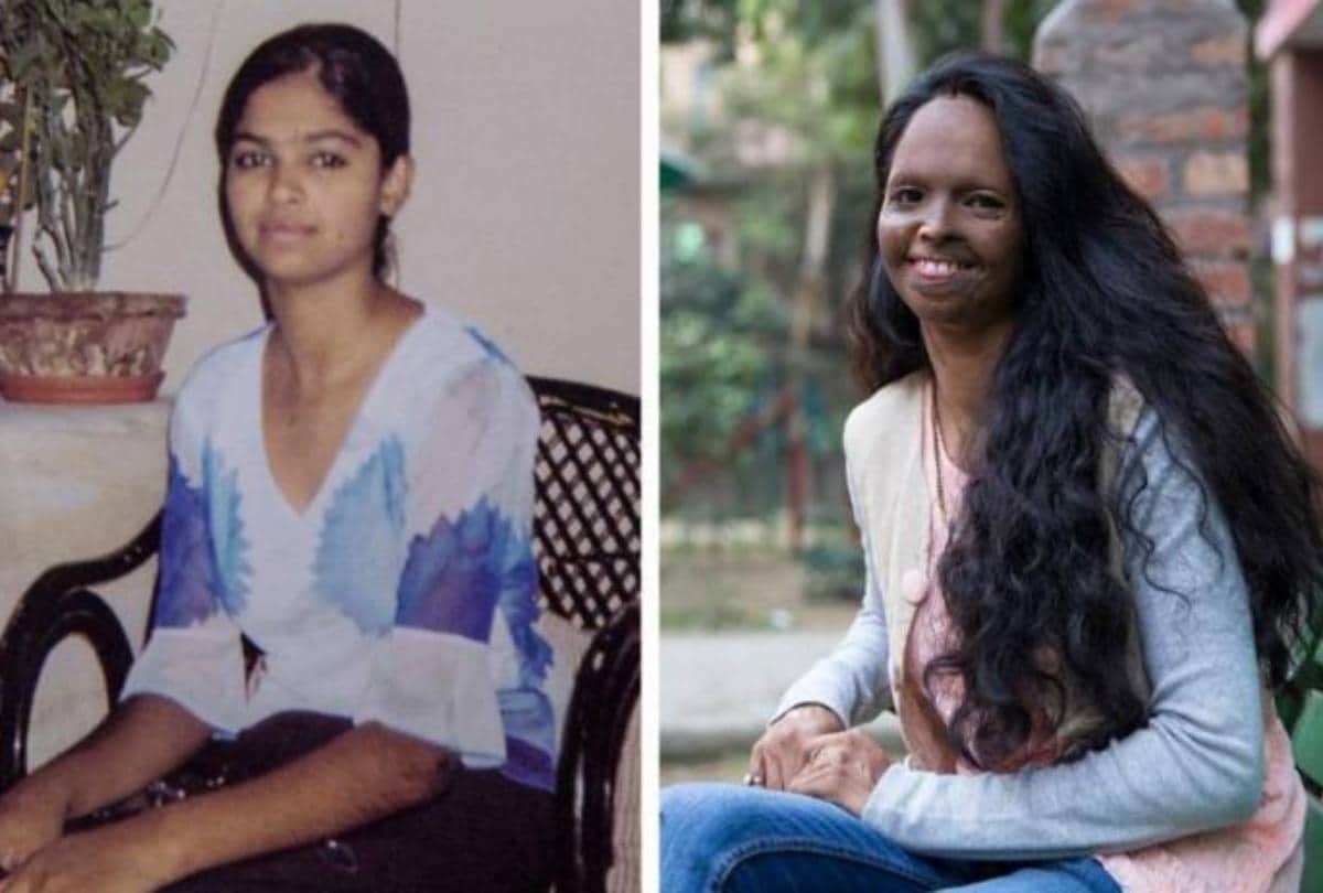 deepika padukone chhapaak laxmi agarwal happy to see her