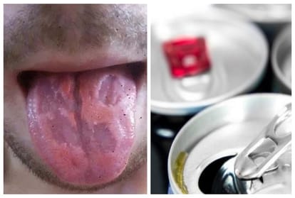 Teacher Shares Photo Of Tongue use to drink 5 to 6 energy drink cans per day  