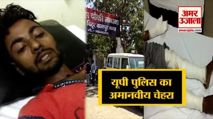 UP police use third degree