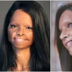 chhapaak