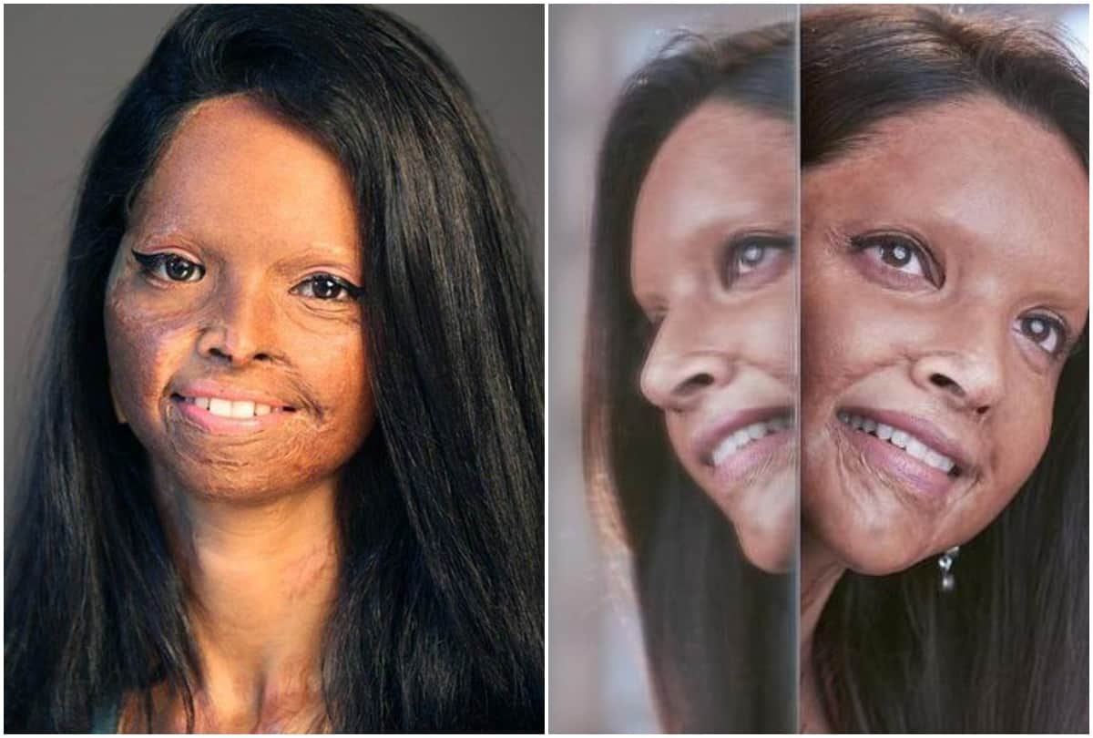 lakshmi agarwal look before acid attack now deepika padukone play role chhapaak