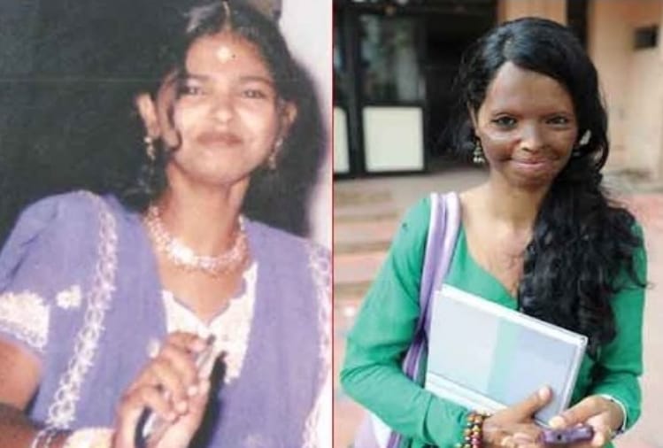 lakshmi agarwal look before acid attack now deepika padukone play role chhapaak