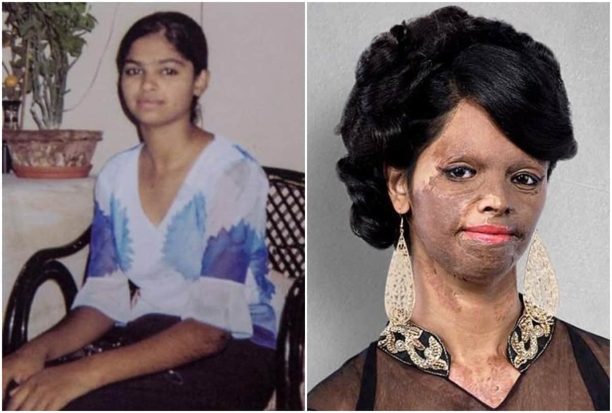 lakshmi agarwal look before acid attack now deepika padukone play role chhapaak