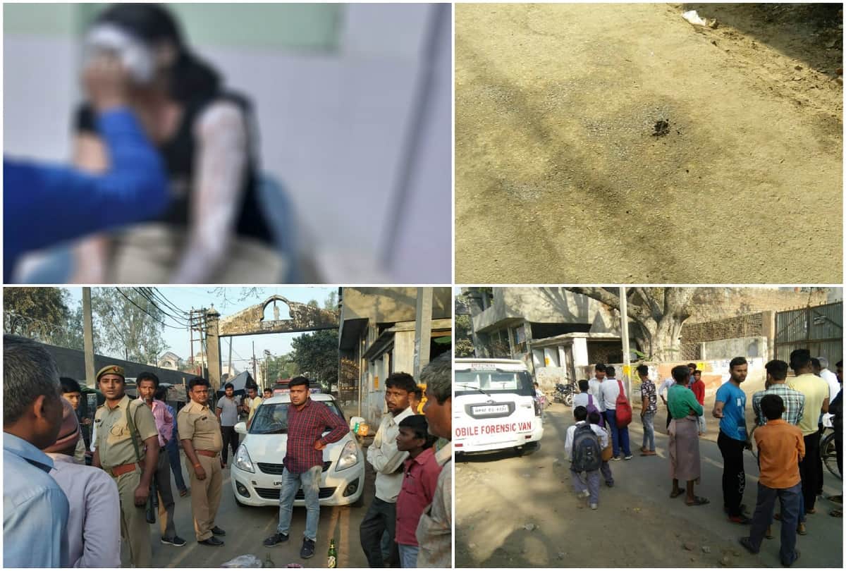 acid attack on women police constable in Mathura