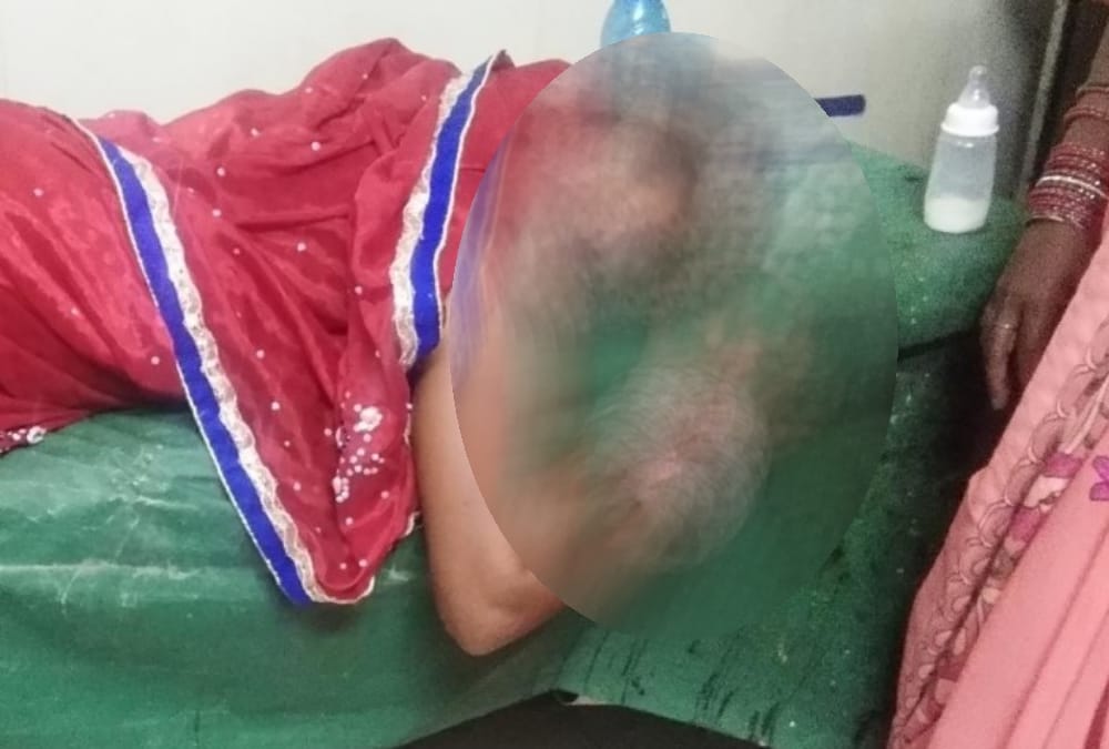 Acid attack on women in maal in lucknow.