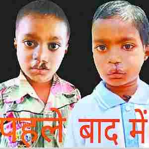 Smile returned to Ankush's face after free operation