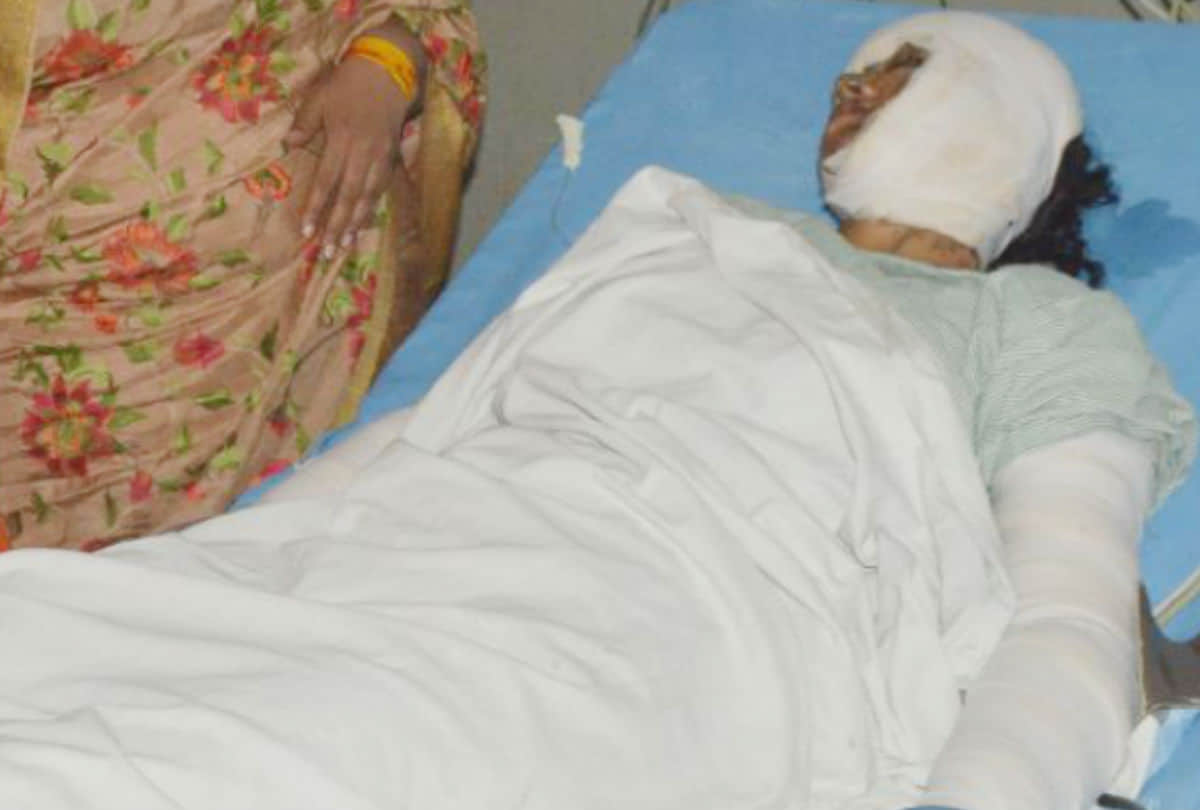 acid attack victim lady cop of up police