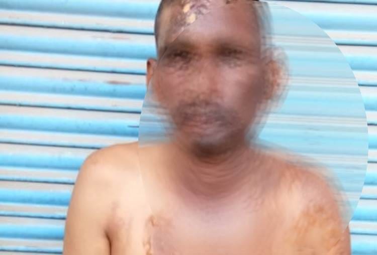 man thrown hot tea and milk on shopkeeper in lucknow