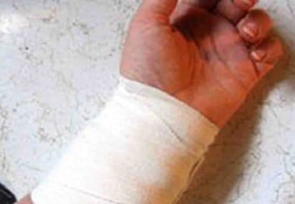 Girl Friend cut wrist vein after live-in partner refused to marry