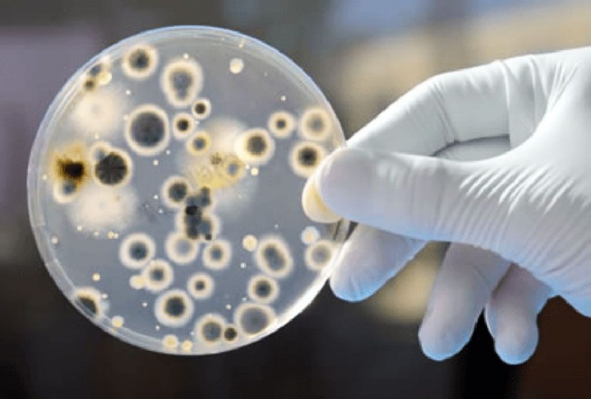 Candida Auris: A Mysterious and Deadly Infection is spreading across the country