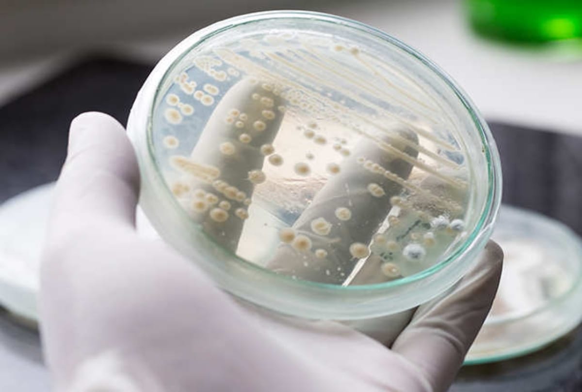America: Deadly Candida auris fungus spread stiflingly, concerns of government and health agencies increased