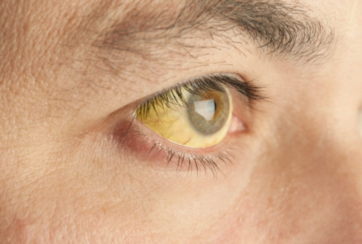 Prevention of Blindness Week 2020 5 ways to protect your eyes