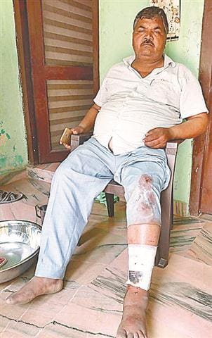 Many injured including veterinary doctor in the attack of the throat
