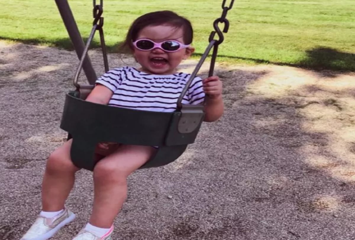 Little Girl Mehlani Big and Beautiful Eyes Are Due To A Rare Genetic Axenfeld Rieger syndrome