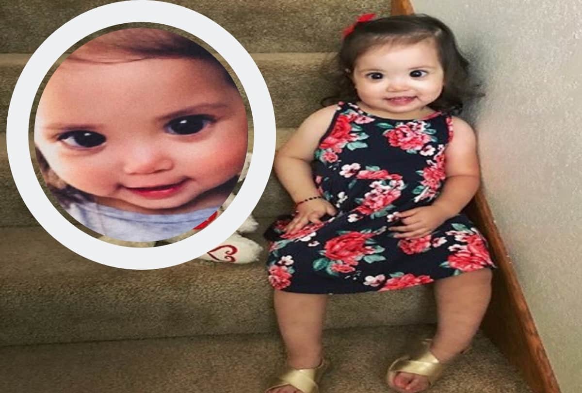 Little Girl Mehlani Big and Beautiful Eyes Are Due To A Rare Genetic Axenfeld Rieger syndrome