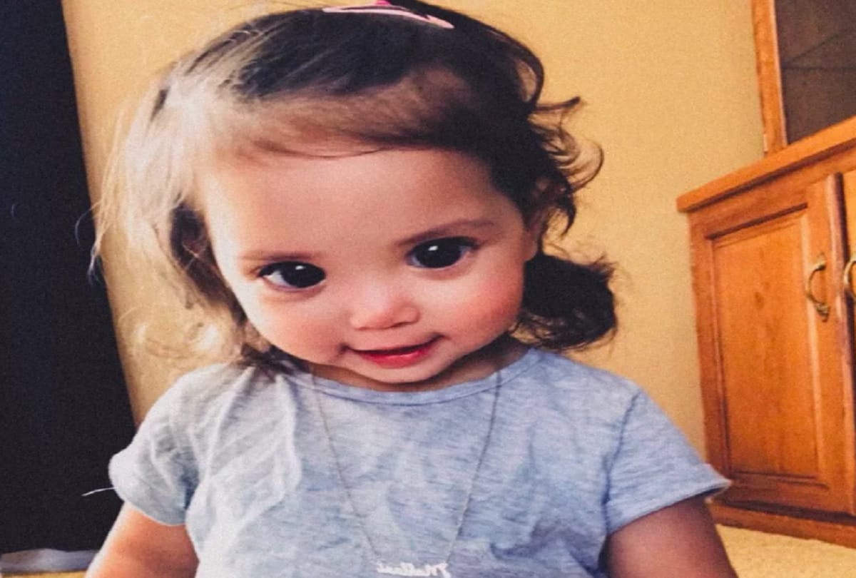 Little Girl Mehlani Big and Beautiful Eyes Are Due To A Rare Genetic Axenfeld Rieger syndrome